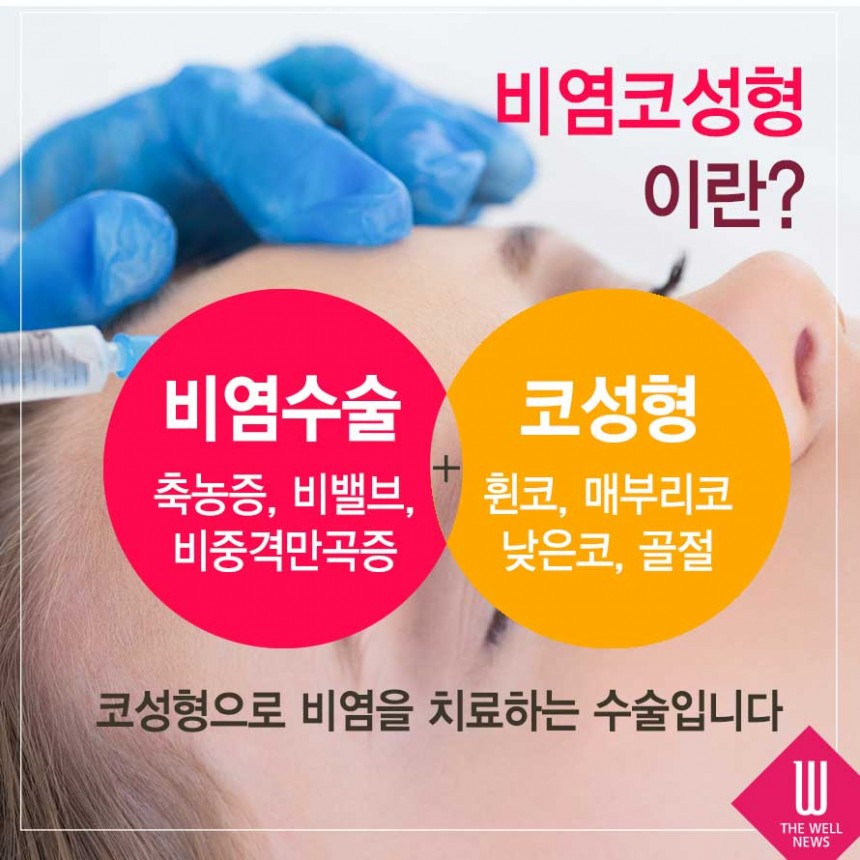 비염을 성형으로 치료한다고요? (3/7)