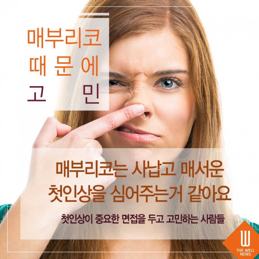 사나운 인상 매부리코성형 비염까지 한 번에 해결! (2/6)