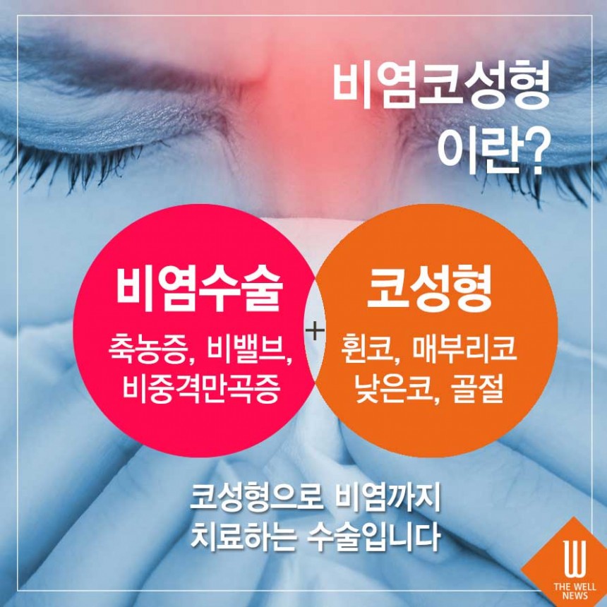 사나운 인상 매부리코성형 비염까지 한 번에 해결! (4/6)