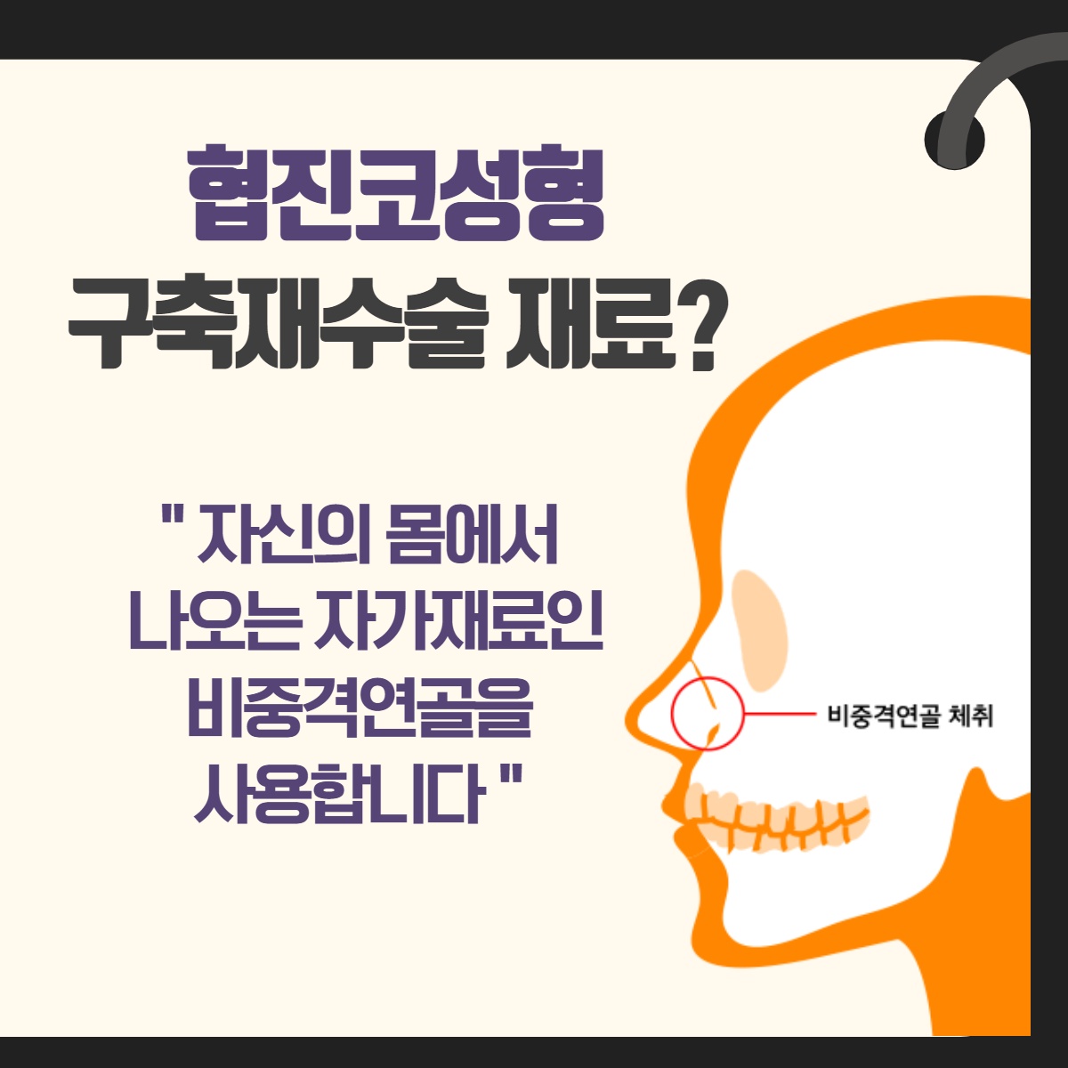 구축코 재수술, 더 이상의 코 수술은 그만! 구축코 협진으로! (8/13)