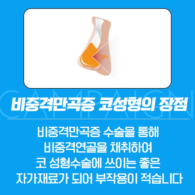 코 성형 왜 기능까지 신경 써야 할까? (7/12)