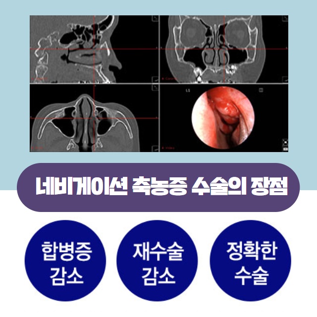 [수원이비인후과] 축농증(부비동염) 원인과 치료 방법! (10/15)