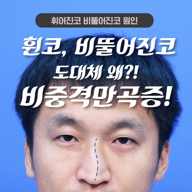 코가 휘어지고 비뚤어진 원인! (1/10)