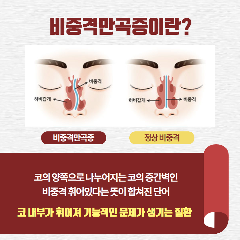 아무 이유 없이 코가 자주 막히는 이유. 코막힘 원인이 있다! (3/8)