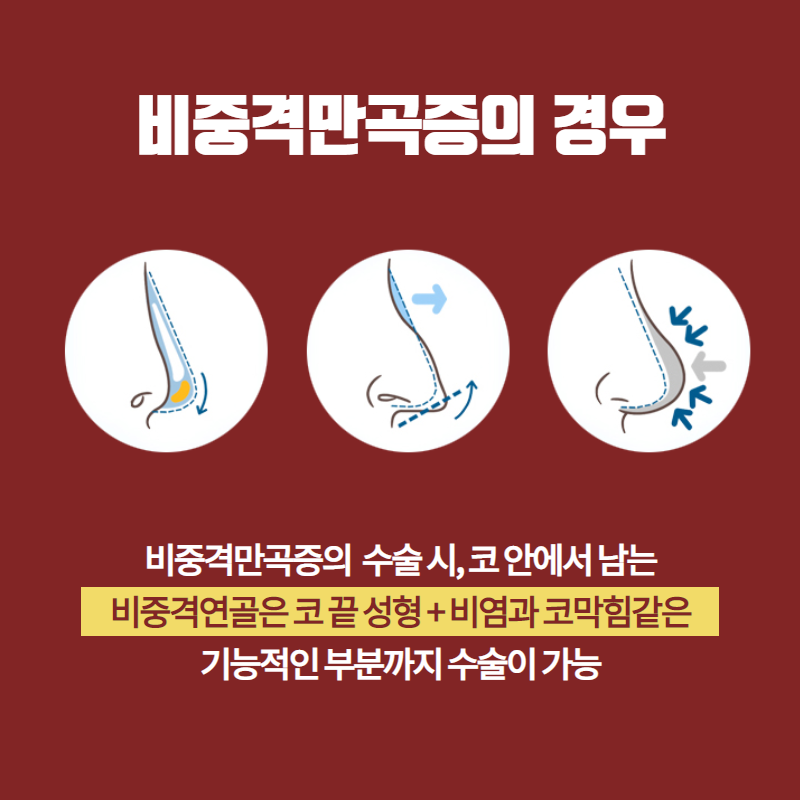 아무 이유 없이 코가 자주 막히는 이유. 코막힘 원인이 있다! (4/8)