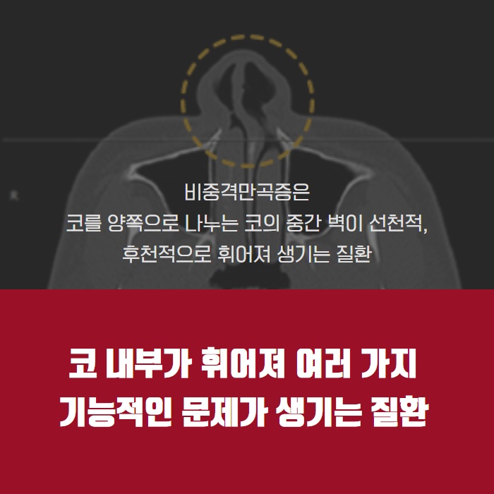 협진코성형 더웰병원이 전하는 비염 코세척 도움이 될까? (2/9)