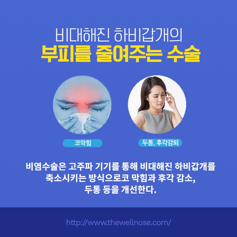 비중격만곡증치료와 코성형을 동시에, 원인과 치료 방법 (3/11)