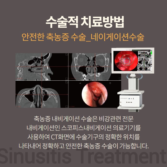 감기와 부비동염 (축농증)의 차이! 원인과 치료방법. (6/11)