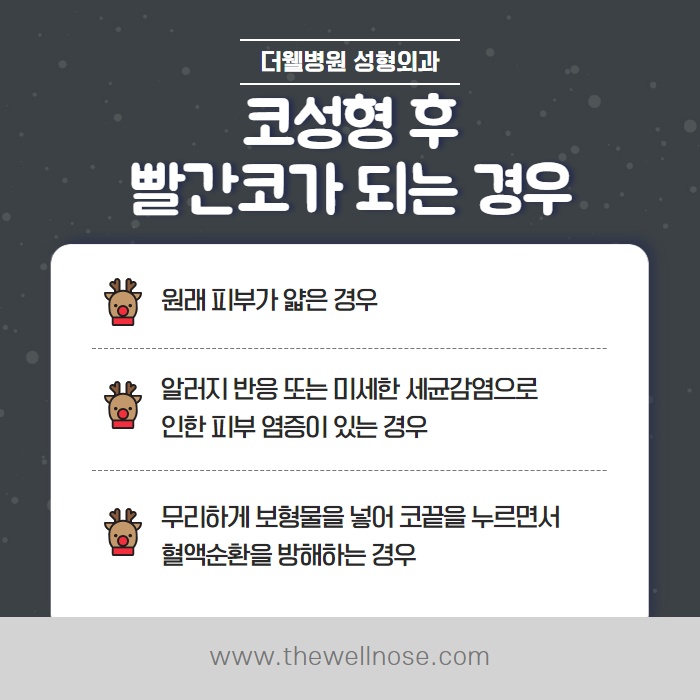 겨울에 코수술하면 딸기코 된다? (4/10)