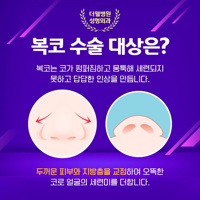 둥글고 뭉특한 코를 오똑하게! 복코성형 (2/9)