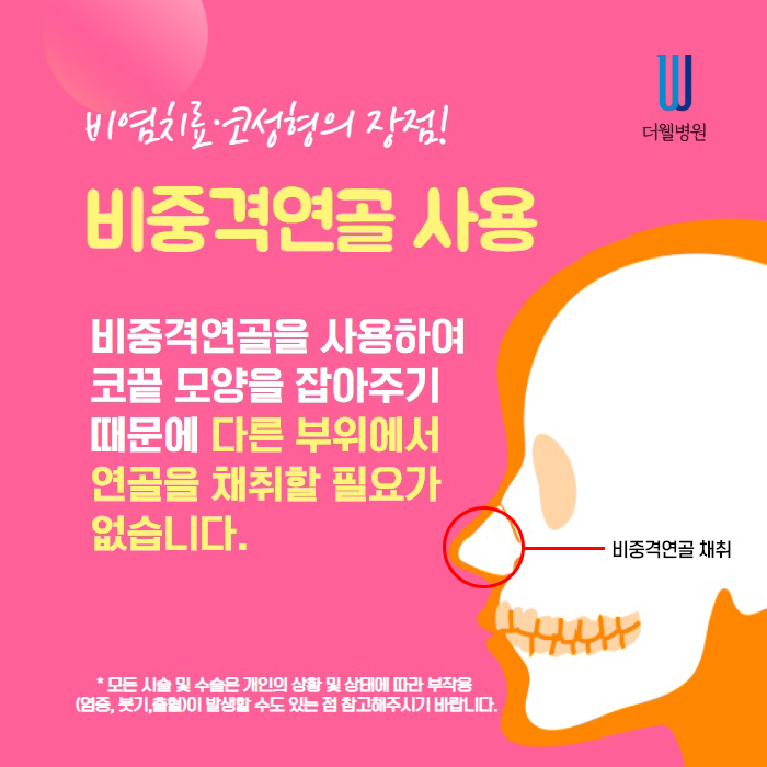 50대 중년 코성형 (5/9)