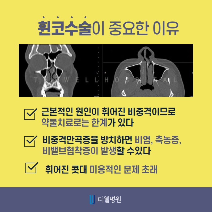 휜 코 성형! 코 내부문제까지 해결해야! (3/9)
