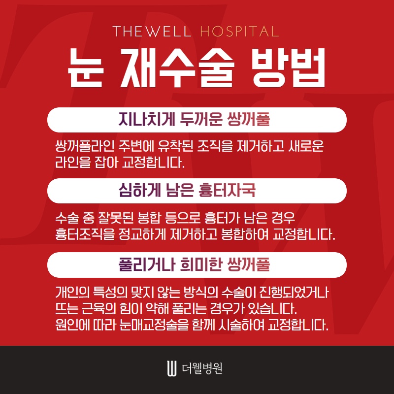 눈 재수술, 더 신중하게 결정하세요! (4/10)