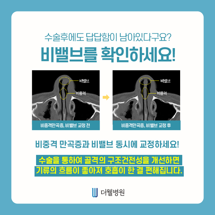 두통, 안면통의 원인 제대로 알아보기! (7/13)