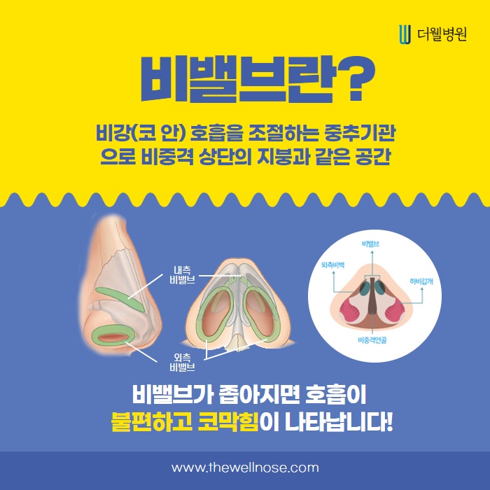 당신의 비밸브 상태는 어떤가요? (2/14)
