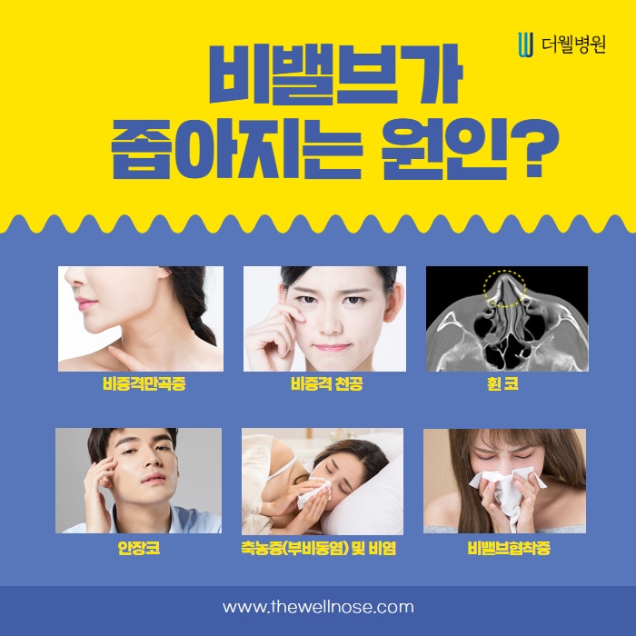 당신의 비밸브 상태는 어떤가요? (3/14)