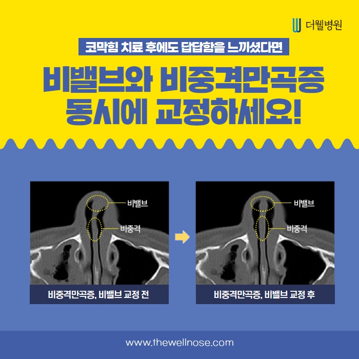 당신의 비밸브 상태는 어떤가요? (8/14)