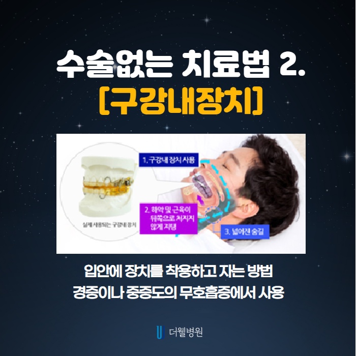 옆 사람 피해주는 코골이, 수면무호흡증 수술 안하는 방법은? (5/11)