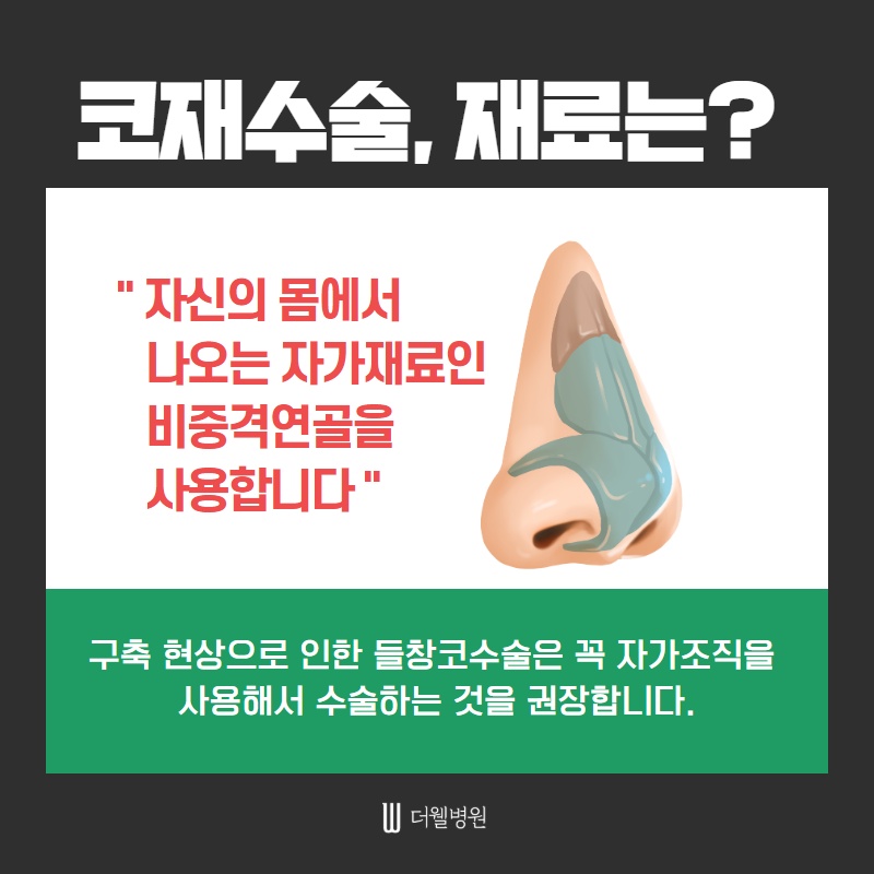코 재수술 키포인트! (4/11)