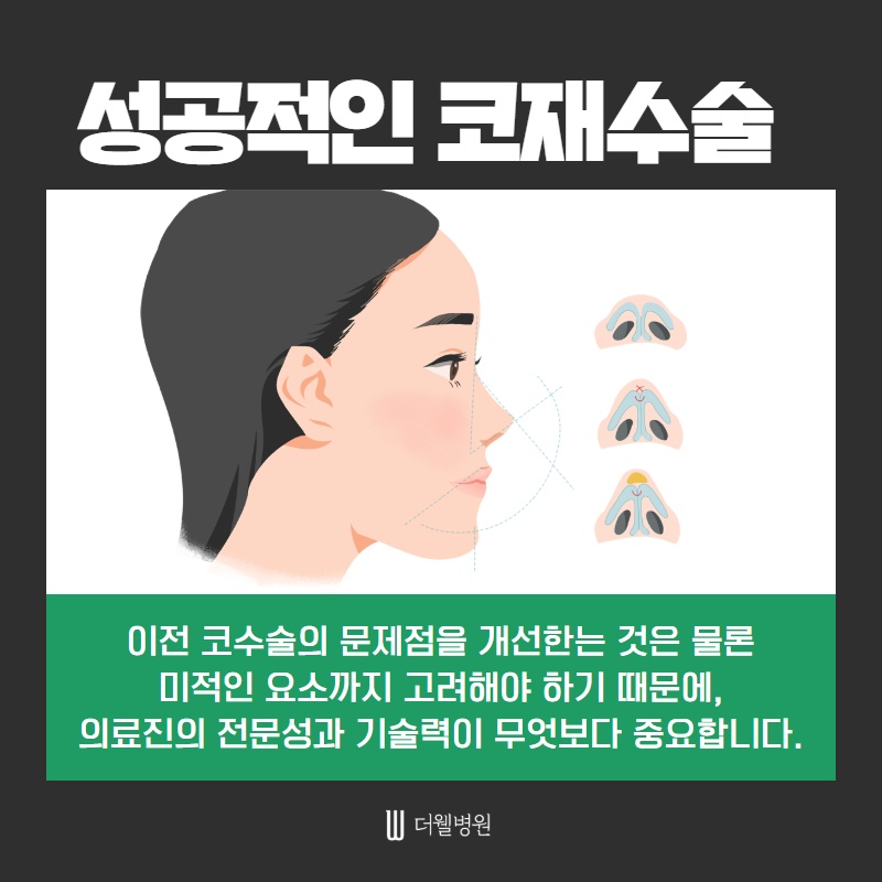 코 재수술 키포인트! (5/11)