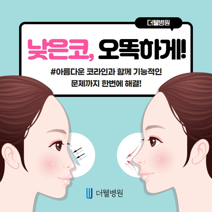 낮은 코, 오똑하게! (1/9)