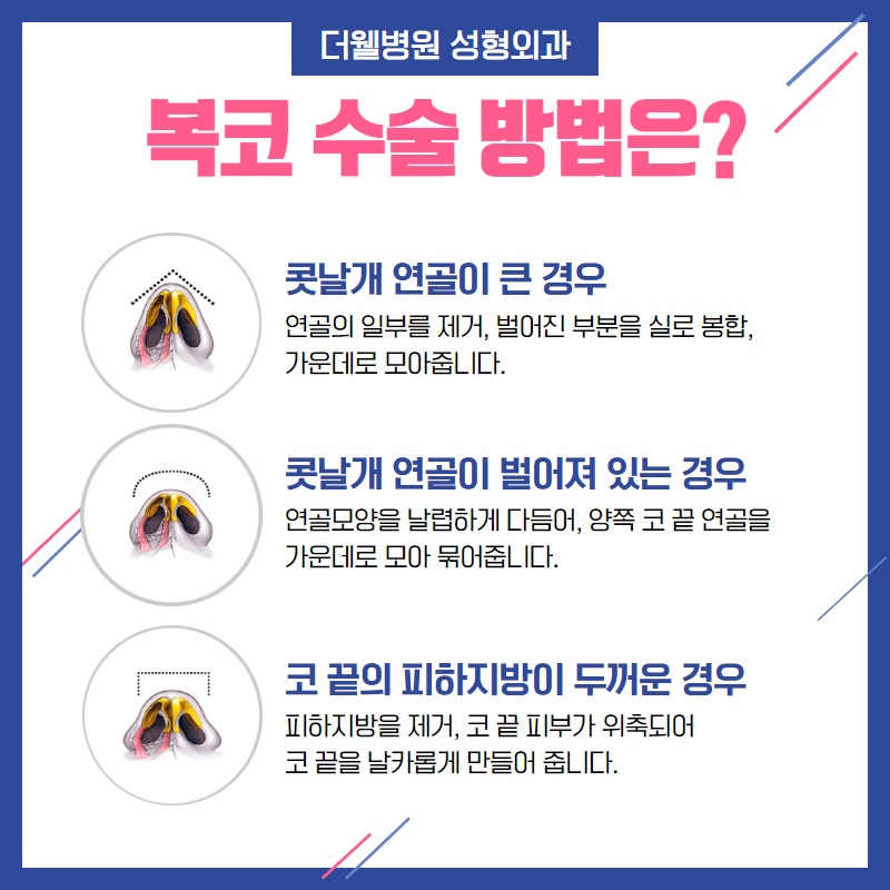 답답하고 뭉툭한 코가 고민이라면? (4/9)