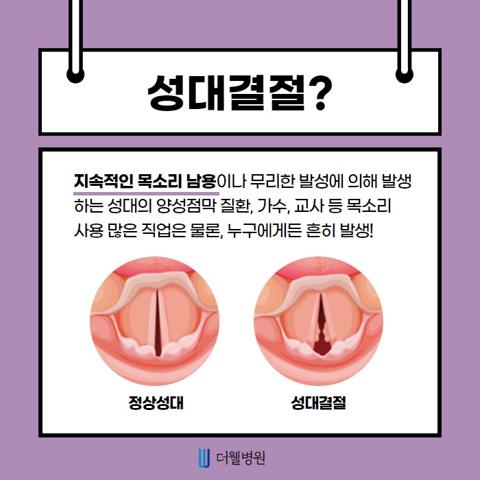 치료보다 예방이 더 중요한 성대결절 (2/11)