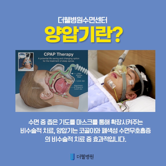 올바른 양압기 선택방법과 보험여부! (2/10)