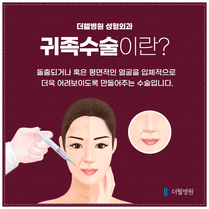 나를 동안으로 만들어줄 귀족수술과 함께하면 좋은 수술은? (2/10)
