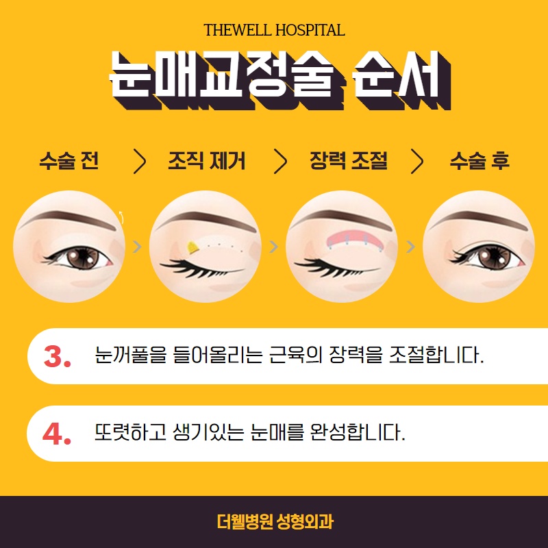 졸리고 처진 눈을 생기있게! (6/11)