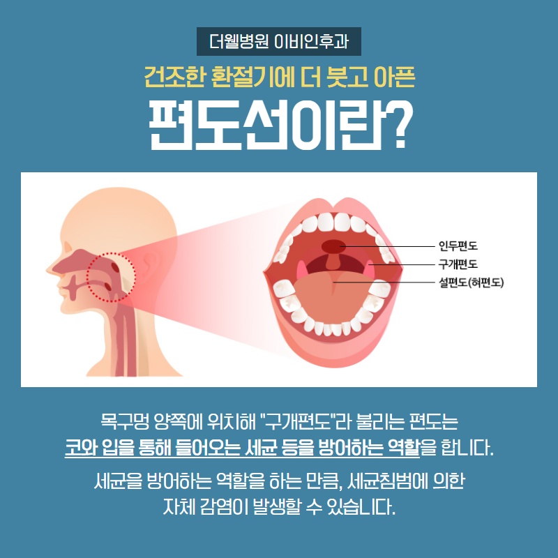 건조한 환절기에 더 붓고 아픈 편도선 제대로 알고 치료하세요! (2/9)