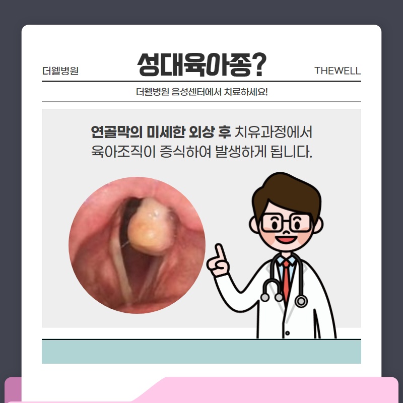 성대육아종 어떻게 치료하나요? (2/10)
