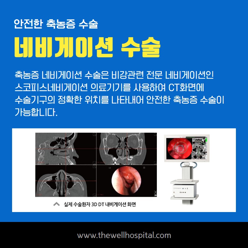 코막힘, 누런콧물 지속될때 감기일까 축농증일까? (7/12)