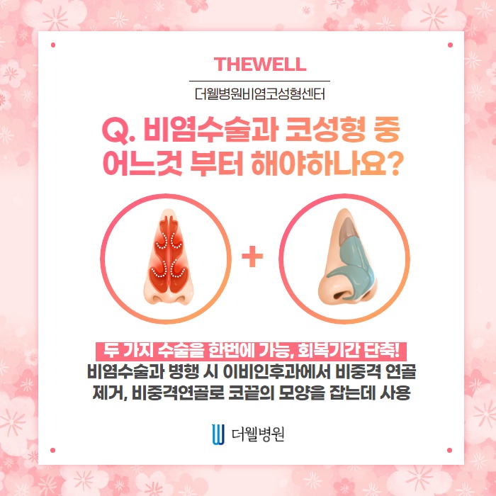 비염수술 코성형 Q&A! (2/10)