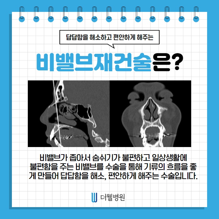 비밸브재건술은 왜 필요할까요? (5/11)