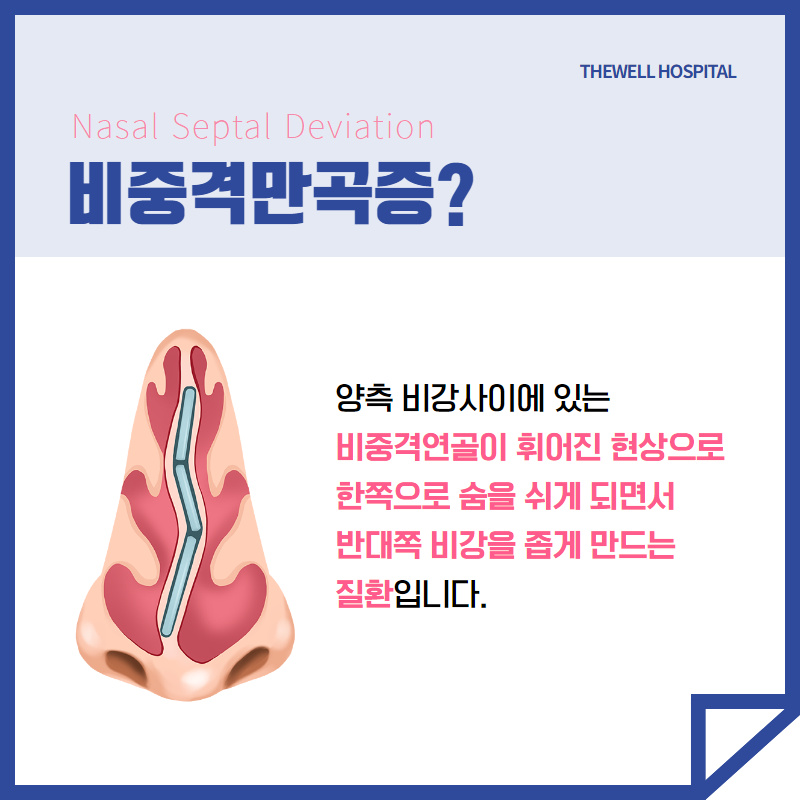 답답한 코막힘의 원인 비중격만곡증! (2/10)