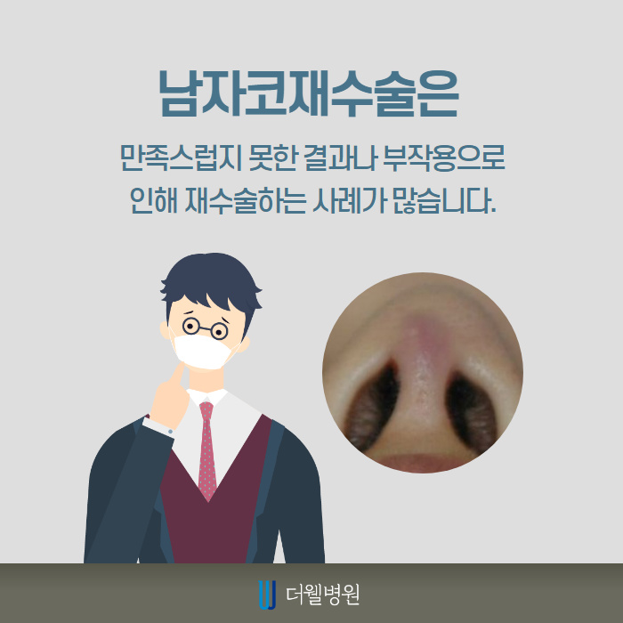 남자 코재수술 반복하지 않으려면? (2/10)