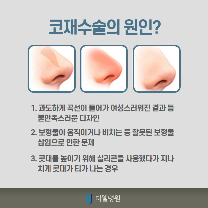 남자 코재수술 반복하지 않으려면? (3/10)