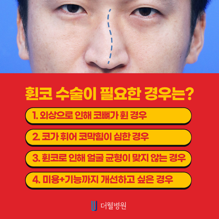 휜 코 성형, 질환까지 개선하자! (4/10)
