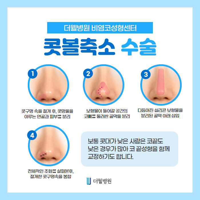낮은코, 오똑한 코라인으로 완성! (3/9)