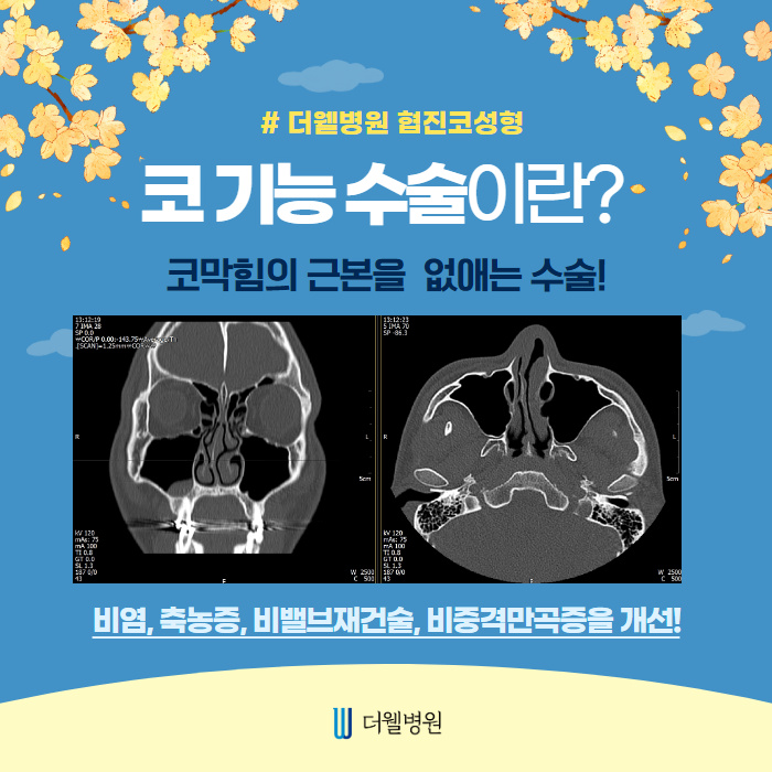 코성형 합리적 비용으로 할 수 있는 방법!! (5/11)