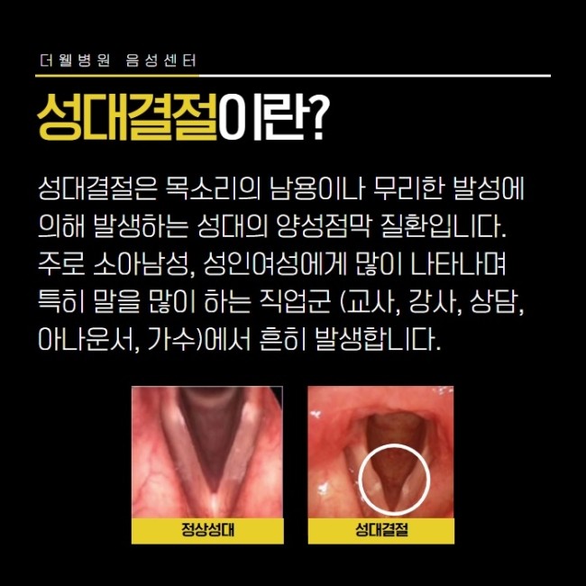 성대결절! 목소리를 지켜라! (2/10)