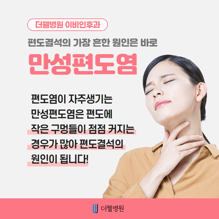심한 입냄새의 원인!! "편도결석" (3/10)