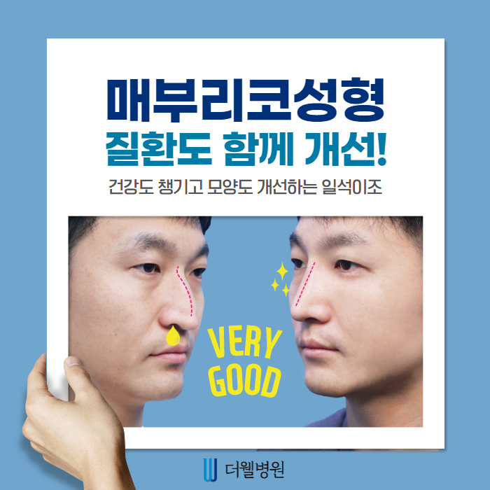 매부리코! 질환도 함께 개선하면 일석이조! (1/10)