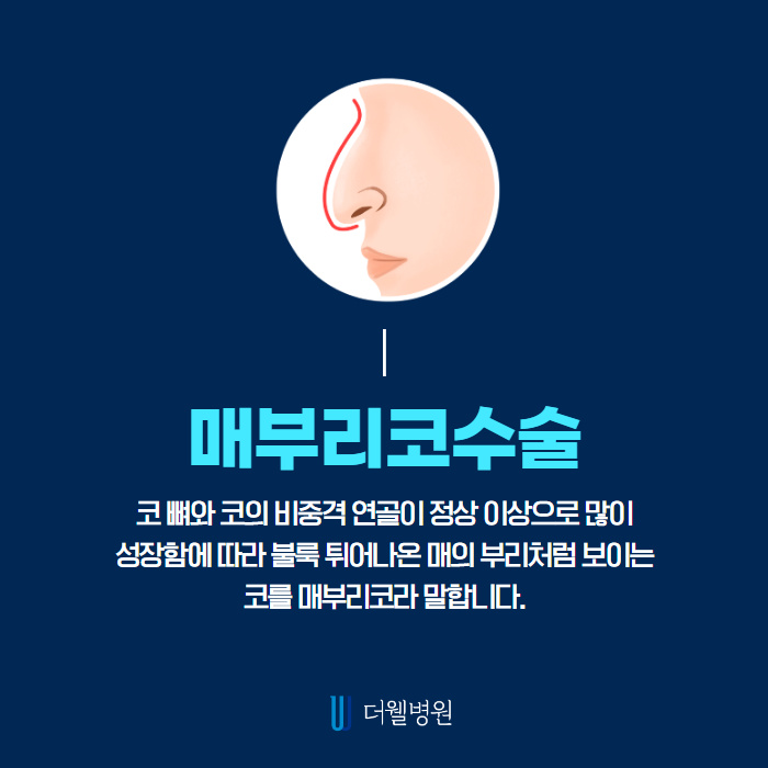매부리코! 질환도 함께 개선하면 일석이조! (2/10)