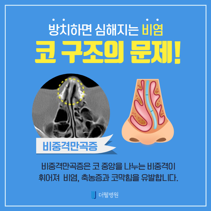 비염수술로 막힌 코를 시원하게! (3/9)