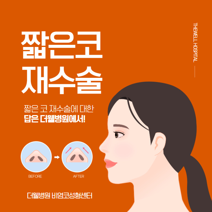 짧은 코 재수술에 대한 해답! (1/9)