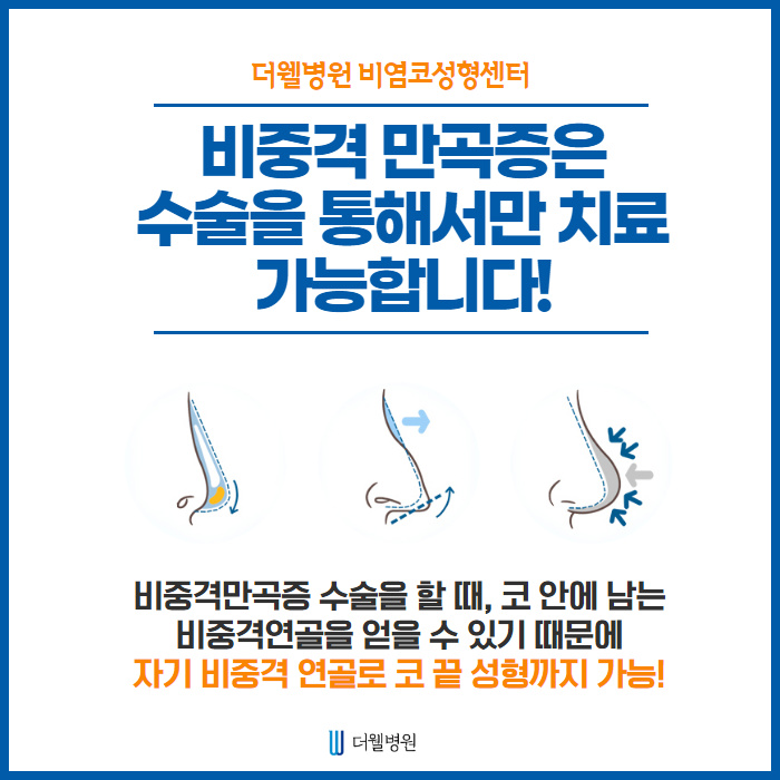 비중격이 휘어지는 이유는?? (5/12)
