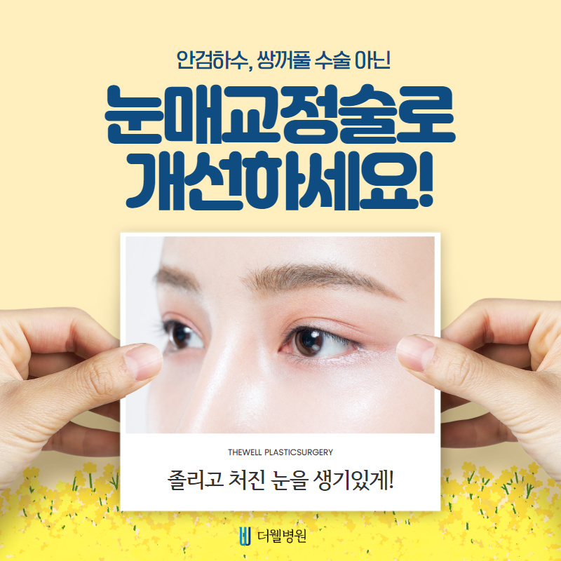 안검하수, 쌍꺼풀이 아닌 눈매교정으로 개선하세요! (1/10)