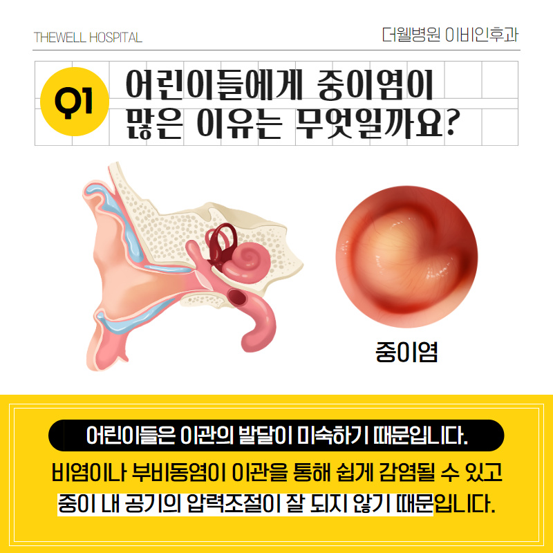 어린이 중이염이 많은 이유는? (2/10)